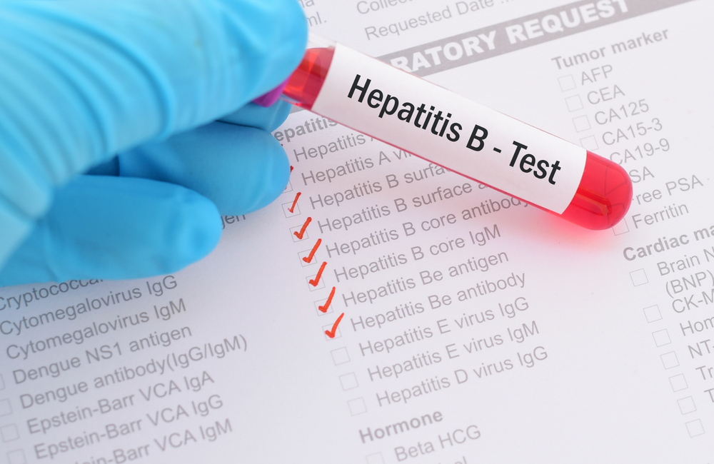 Harapan Baru Hepatitis B: Bepirovirsen Berhasil Menghilangkan HBsAg pada Sebagian Pasien